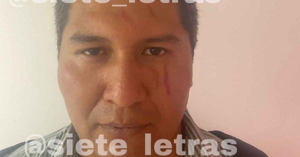 Capturan a asesino serial en Iztacalco, CDMX