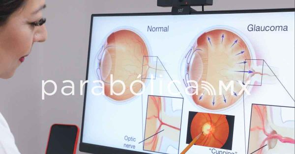 Hay que prevenir glaucoma porque genera ceguera: IMSS