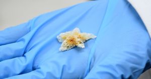 Crean investigadores BUAP esponjas biodegradables para regeneración ósea