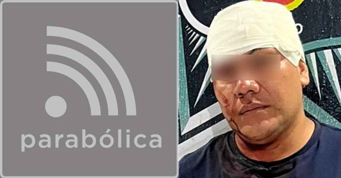 Realizó tocamientos lascivos a una mujer de Atlixco; ya fue detenido