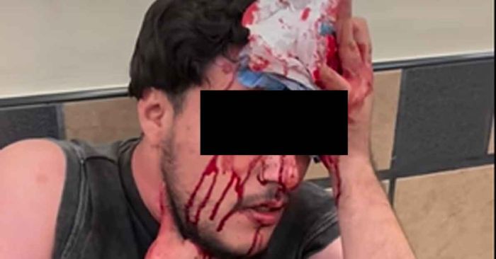 Atacan a cliente de La Oriental en la CAPU; agresor ya estaría identificado